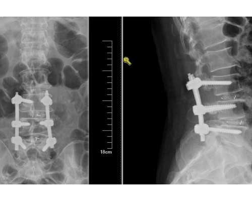 内蒙古私立供卵试管医院,玉林第一人民医院试管你想要的技术都在这里-上海供